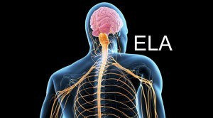 Caro leitor hoje vamos entender os mecanismos e a forma de atuação da Esclerose Lateral Amiotrófica (ELA).